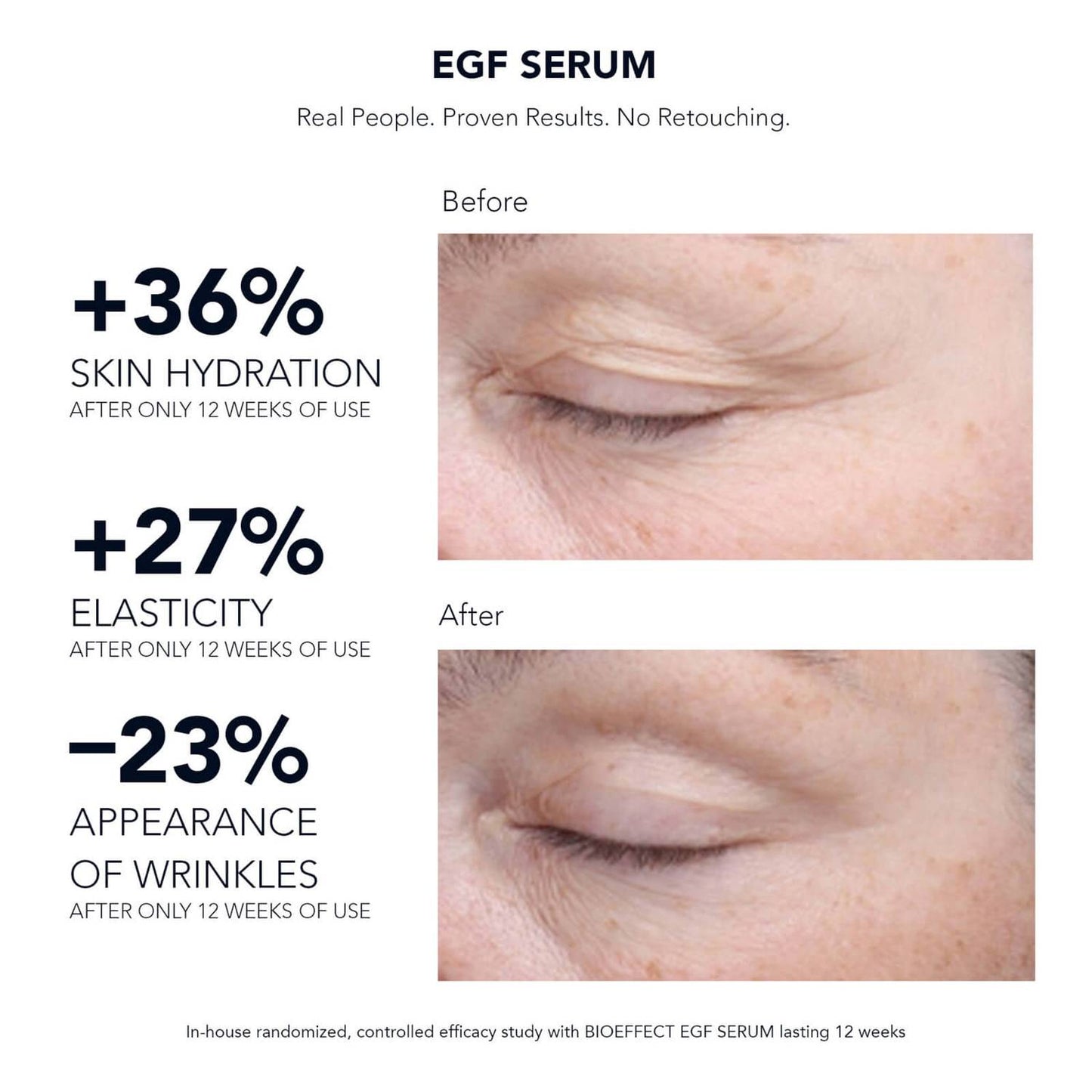 BIOEFFECT EGF Serum 15 ml